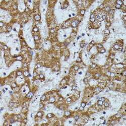 Invitrogen ApoC3 Polyclonal Antibody 100 &mu;L | Buy Online | Invitrogen&trade; | Fisher Scientific
