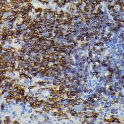 Invitrogen ApoC3 Polyclonal Antibody 100 &mu;L | Buy Online | Invitrogen&trade; | Fisher Scientific
