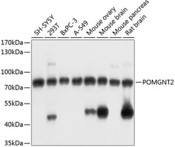 Invitrogen POMGNT2 Polyclonal Antibody 100 &mu;L; Unconjugated:Antibodies,
