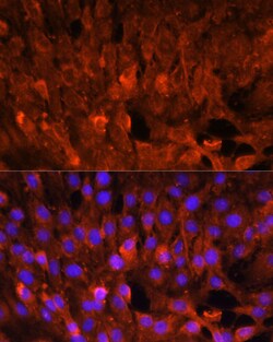 Invitrogen CIS Polyclonal Antibody 100 &mu;L; Unconjugated:Antibodies,