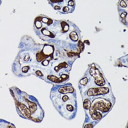 Invitrogen Fibrinogen alpha chain Polyclonal Antibody 100 &mu;L; Unconjugated:Antibodies,