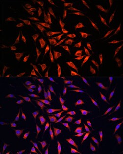 Invitrogen GSDMC Polyclonal Antibody 100 &mu;L | Buy Online | Invitrogen&trade; | Fisher Scientific