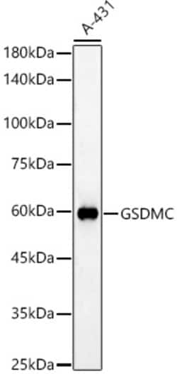 Invitrogen GSDMC Polyclonal Antibody 100 &mu;L | Buy Online | Invitrogen&trade; | Fisher Scientific