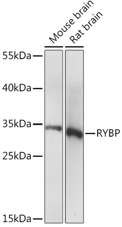 Invitrogen RYBP Polyclonal Antibody 100 &mu;L; Unconjugated:Antibodies,