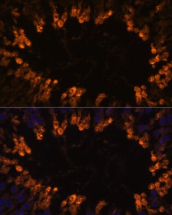 Invitrogen OXCT2 Polyclonal Antibody 100 &mu;L; Unconjugated:Antibodies,