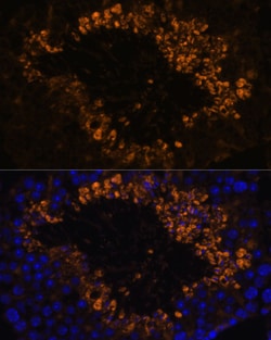 Invitrogen OXCT2 Polyclonal Antibody 100 &mu;L; Unconjugated:Antibodies,