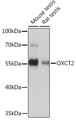 Invitrogen OXCT2 Polyclonal Antibody 100 &mu;L; Unconjugated:Antibodies,