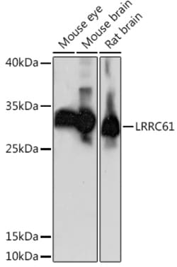 Invitrogen LRRC61 Polyclonal Antibody 100 &mu;L; Unconjugated:Antibodies,