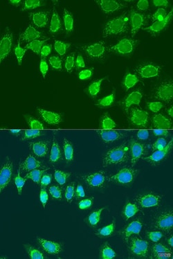 Invitrogen L2HGDH Polyclonal Antibody 100 &mu;L; Unconjugated:Antibodies,
