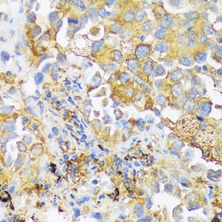 Invitrogen ZDHHC18 Polyclonal Antibody 100 &mu;L; Unconjugated:Antibodies,