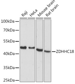 Invitrogen ZDHHC18 Polyclonal Antibody 100 &mu;L; Unconjugated:Antibodies,