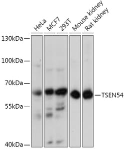Invitrogen TSEN54 Polyclonal Antibody 100 &mu;L; Unconjugated:Antibodies,