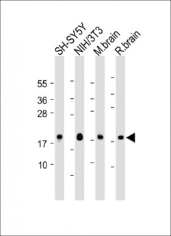 Invitrogen Calmodulin Polyclonal Antibody 400 &mu;L; Unconjugated:Antibodies,