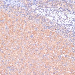 Invitrogen KANK2 Polyclonal Antibody 100 &mu;L; Unconjugated:Antibodies,