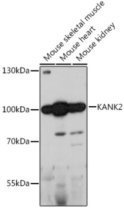 Invitrogen KANK2 Polyclonal Antibody 100 &mu;L; Unconjugated:Antibodies,