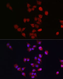 APC11 Polyclonal Antibody:Antibodies, Polyclonal