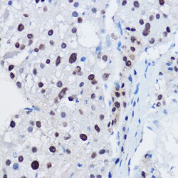 APC11 Polyclonal Antibody:Antibodies, Polyclonal