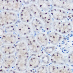 APC11 Polyclonal Antibody:Antibodies, Polyclonal