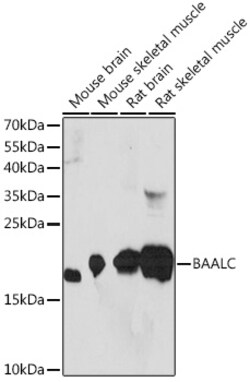 BAALC Polyclonal Antibody:Antibodies, Polyclonal