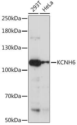 Invitrogen KCNH6 Polyclonal Antibody 100 &mu;L; Unconjugated:Antibodies,