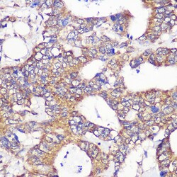 Invitrogen GCP6 Polyclonal Antibody 100 &mu;L; Unconjugated:Antibodies,