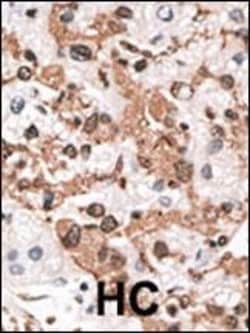 Invitrogen KChIP3 Polyclonal Antibody 400 &mu;L; Unconjugated:Antibodies,