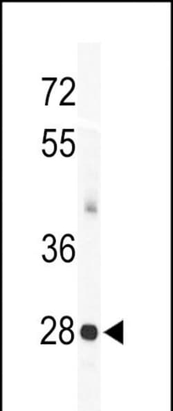 Invitrogen KChIP3 Polyclonal Antibody 400 &mu;L; Unconjugated:Antibodies,