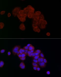 Invitrogen PGAM5 Polyclonal Antibody 100 &mu;L | Buy Online | Invitrogen&trade; | Fisher Scientific
