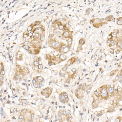 Invitrogen PGAM5 Polyclonal Antibody 100 &mu;L | Buy Online | Invitrogen&trade; | Fisher Scientific