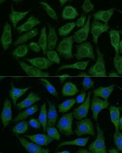 Invitrogen RAPGEF1 Polyclonal Antibody 100 &mu;L; Unconjugated:Antibodies,
