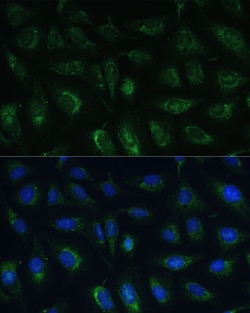 Invitrogen RAPGEF1 Polyclonal Antibody 100 &mu;L; Unconjugated:Antibodies,