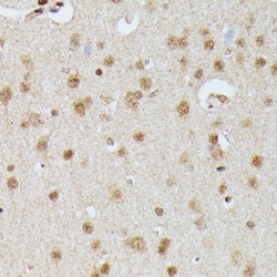 Invitrogen IGHMBP2 Polyclonal Antibody 100 &mu;L; Unconjugated:Antibodies,