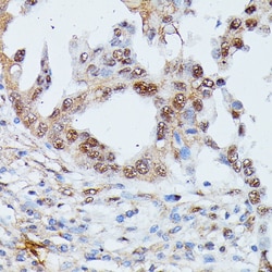 Invitrogen IGHMBP2 Polyclonal Antibody 100 &mu;L; Unconjugated:Antibodies,