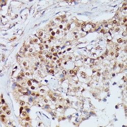 Invitrogen IGHMBP2 Polyclonal Antibody 100 &mu;L; Unconjugated:Antibodies,