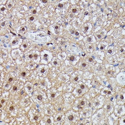 Invitrogen IGHMBP2 Polyclonal Antibody 100 &mu;L; Unconjugated:Antibodies,