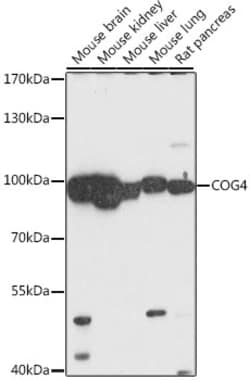 Invitrogen COG4 Polyclonal Antibody 100 &mu;L | Buy Online | Invitrogen&trade; | Fisher Scientific