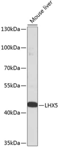 Invitrogen LHX5 Polyclonal Antibody 100 μL; Unconjugated:Antibodies,