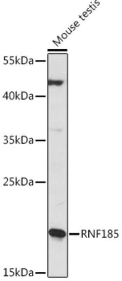 Invitrogen RNF185 Polyclonal Antibody 100 &mu;L; Unconjugated:Antibodies,