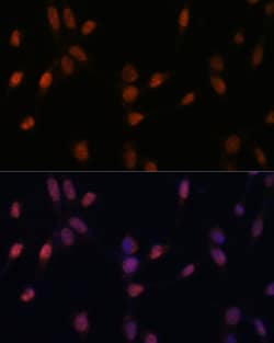 Invitrogen USP33 Polyclonal Antibody 100 &mu;L; Unconjugated:Antibodies,
