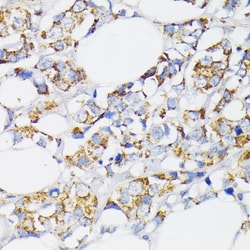 Invitrogen USP33 Polyclonal Antibody 100 &mu;L; Unconjugated:Antibodies,