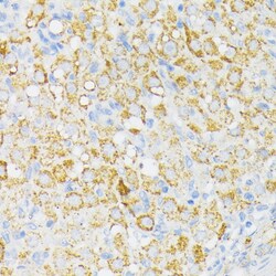 Invitrogen USP33 Polyclonal Antibody 100 &mu;L; Unconjugated:Antibodies,