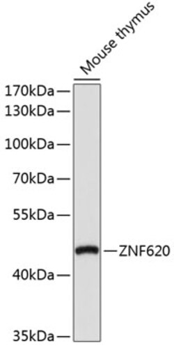 Invitrogen ZNF620 Polyclonal Antibody 100 &mu;L; Unconjugated:Antibodies,