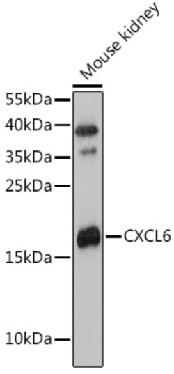 Invitrogen CXCL6 Polyclonal Antibody 100 &mu;L; Unconjugated:Antibodies,