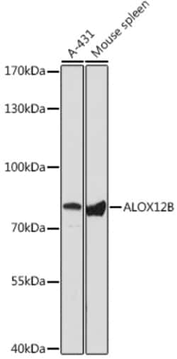 Invitrogen ALOX12B Polyclonal Antibody 100 &mu;L; Unconjugated:Antibodies,
