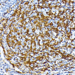 Invitrogen CK1 alpha Polyclonal Antibody 100 &mu;L | Buy Online | Invitrogen&trade; | Fisher Scientific