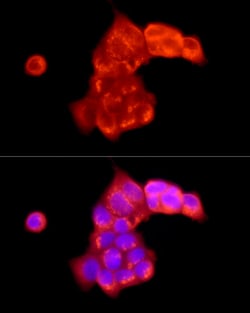 Invitrogen ATP6V0C Polyclonal Antibody 100 &mu;L; Unconjugated:Antibodies,