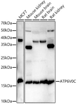 Invitrogen ATP6V0C Polyclonal Antibody 100 &mu;L; Unconjugated:Antibodies,