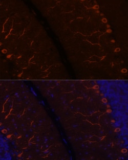 Invitrogen KAL1 Polyclonal Antibody 100 &mu;L; Unconjugated:Antibodies,