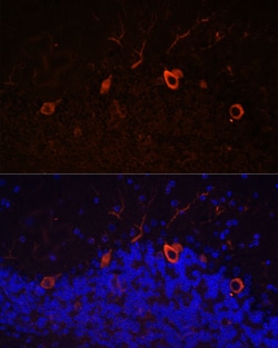 Invitrogen KAL1 Polyclonal Antibody 100 &mu;L; Unconjugated:Antibodies,