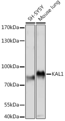 Invitrogen KAL1 Polyclonal Antibody 100 &mu;L; Unconjugated:Antibodies,